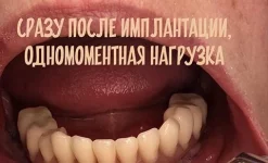 стоматология новодент на улице ленина изображение 4 на проекте infodoctor.ru