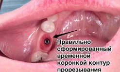 стоматология новодент на улице ленина изображение 7 на проекте infodoctor.ru