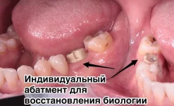 стоматология новодент на улице ленина изображение 2 на проекте infodoctor.ru